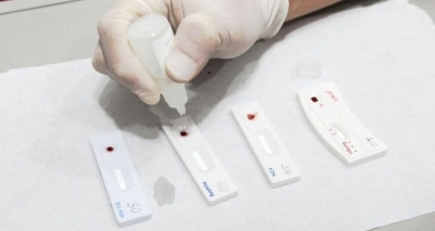 Autoteste de HIV estará disponível nacionalmente em farmácias até o fim de julho